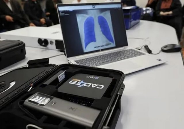 Искусственный интеллект ускорит диагностику в больницах Туркменистана